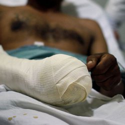 A man awaits an operation having fallen from the roof of the train (photo by Marc Silver)