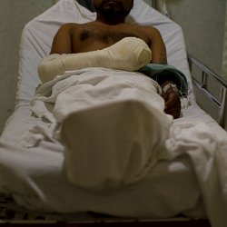 A man awaits an operation having fallen from the roof of the train. (photo by Marc Silver)